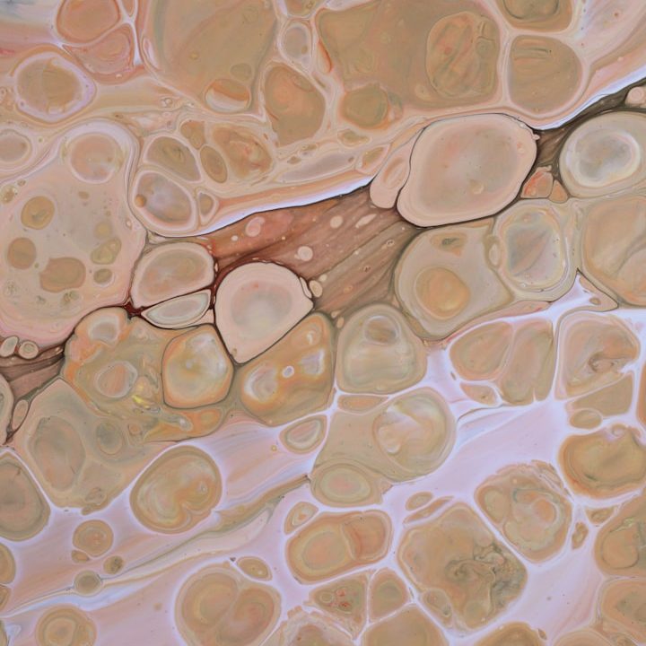 Textura abstracta en tonos beige y marrón con formas redondeadas y líneas sutiles. Hidrolipoclasia Ultrasónica.