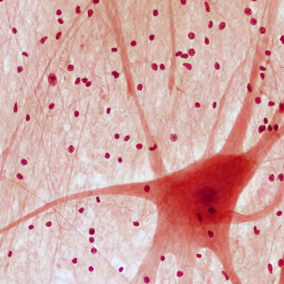 Neurona en un fondo de tejido nervioso, con células y prolongaciones visibles.